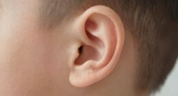 check ear flaps regularly