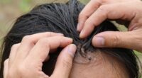 check for tick bites