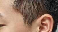 ear hair matting hidden